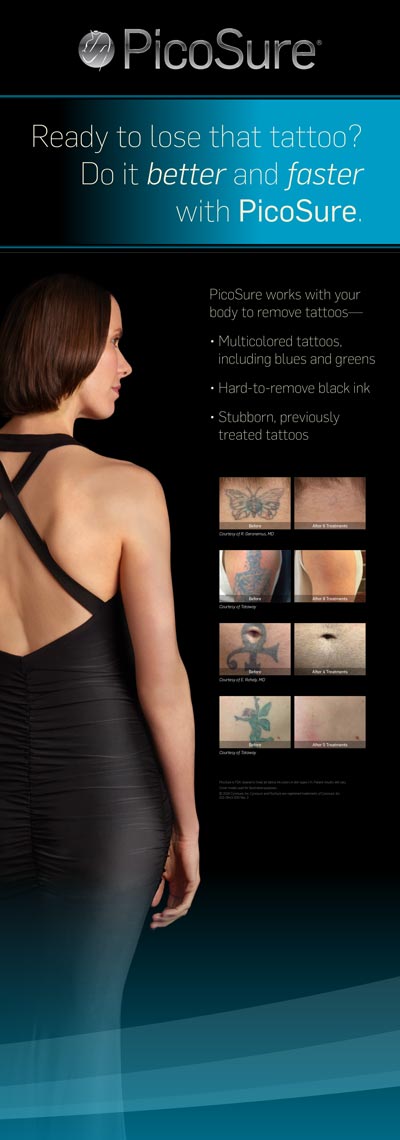 Tattoo-Removal-Bannerstand