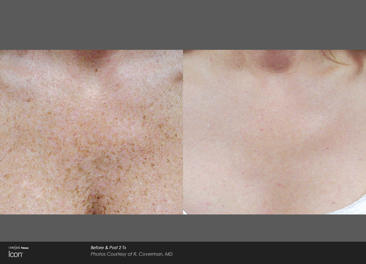 Skin-Revitalization-Before-&-After-Photo-7